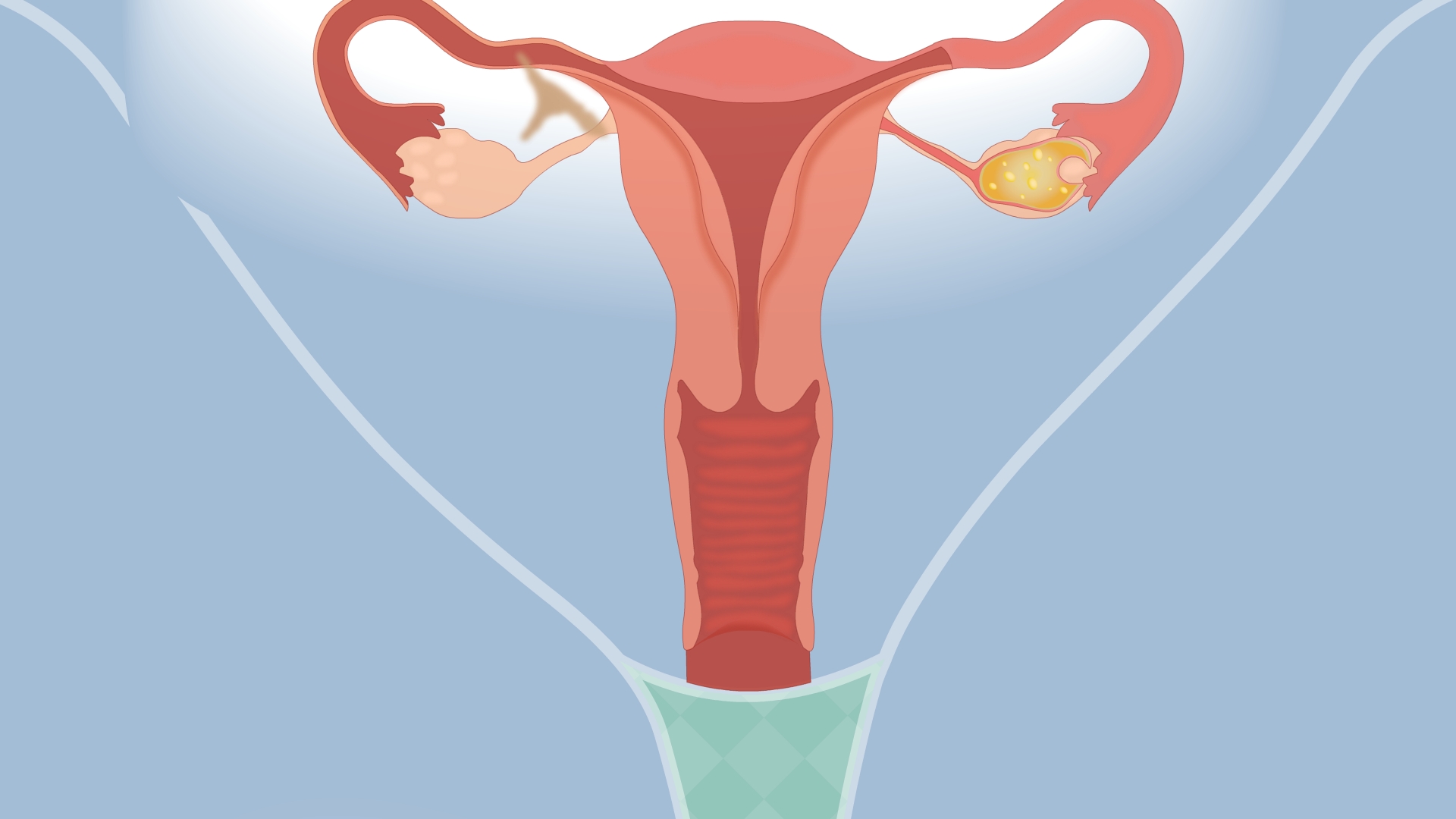 女性私护有炎症的正确清洗方法,女性私护可以天天用清水洗吗