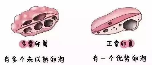 什么样的卵泡才能快速怀孕？
