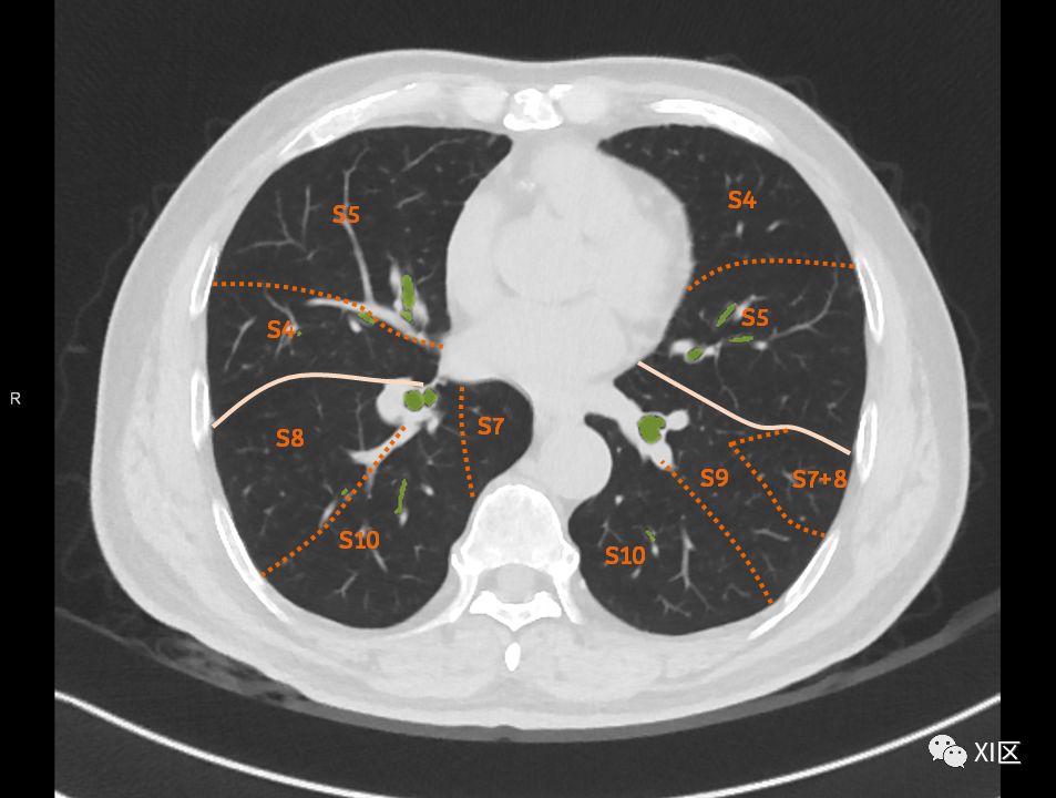 如此详细的肺部影像解剖，有点儿酷！