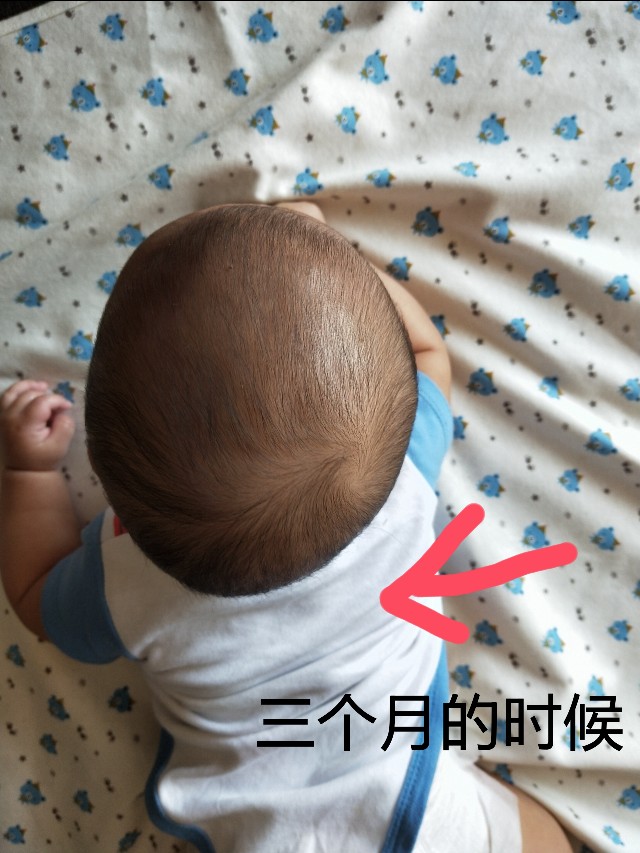 不做后悔妈妈,偏头的宝宝怎么做才能调整过来