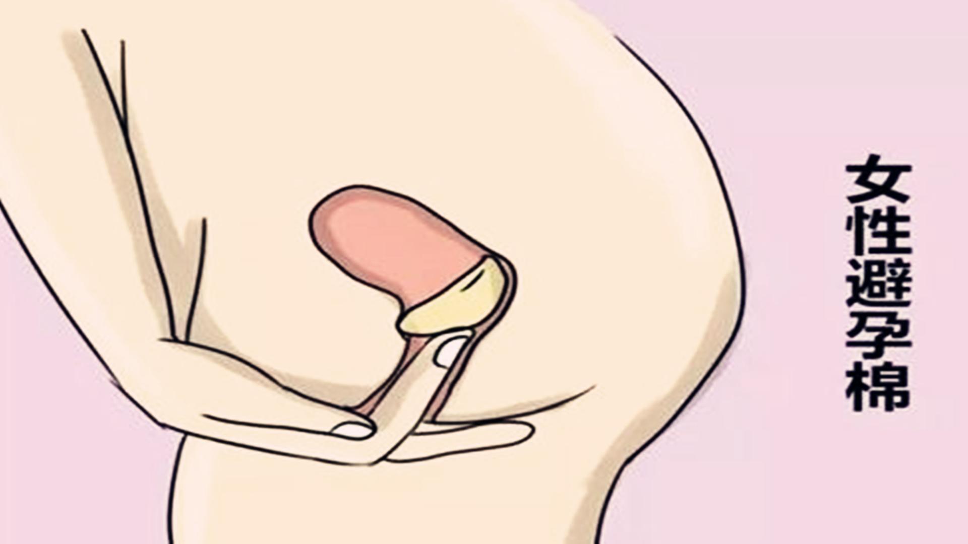 避孕最好方法和最安全的方法,女性有几种避孕措施