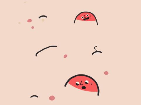 祛痘去黑头五次多少钱,祛痘100块钱