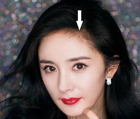 女生头发太贴头皮怎么处理,女生头发太少太软太贴头皮怎么办