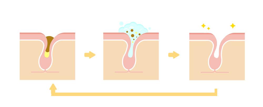 去黑头收缩毛孔十滴水,碘伏十滴水祛黑头