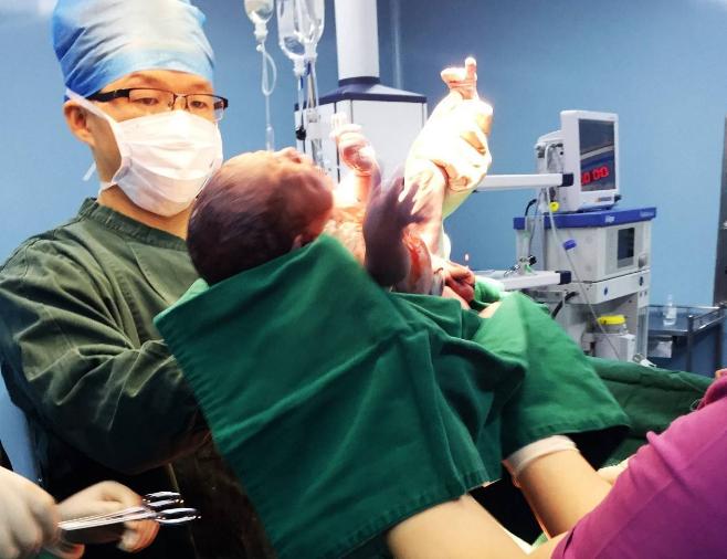 顺产后医生给掏出血怎么回事,顺产后医生为什么用手掏肚子