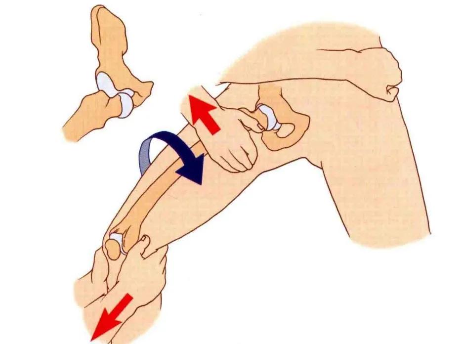 犬髋关节脱位闭合复位,髋关节脱位的闭合复位