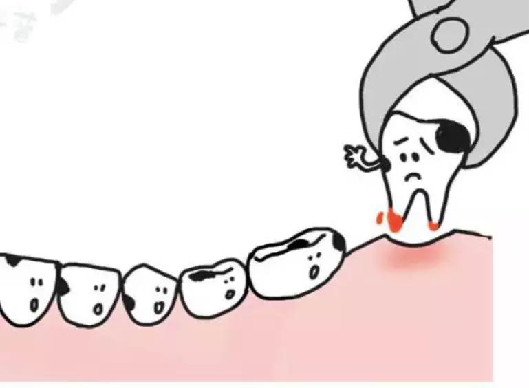 牙齿涂氟小知识,有氟牙可以涂氟吗