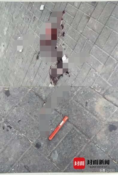 初中生遭同学割喉后续,少年遭同学割喉滞留53天