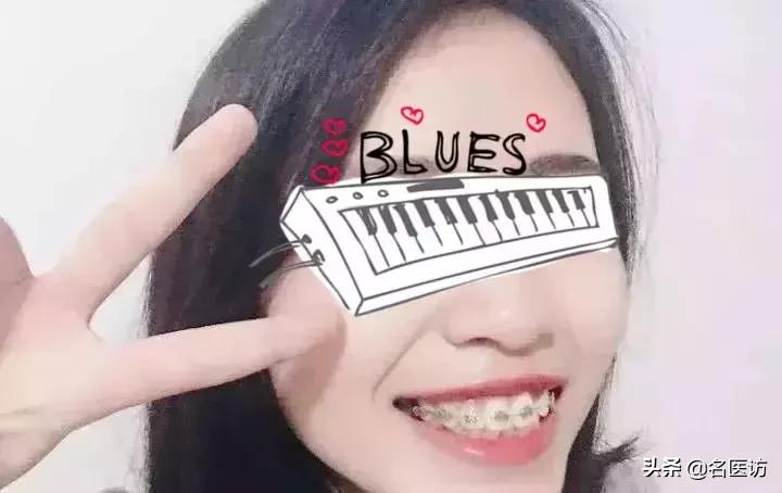 矫正牙齿后牙掉了,矫正牙齿只拔上面2颗牙