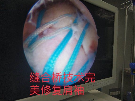 关注颈肩腰痛,关注颈肩腰腿疼痛