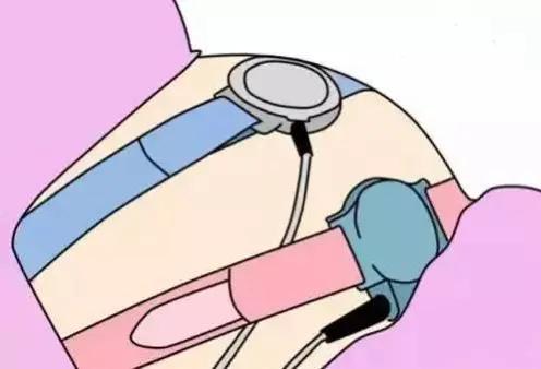 孕19周有一点点血算见红吗,怀孕19周见红