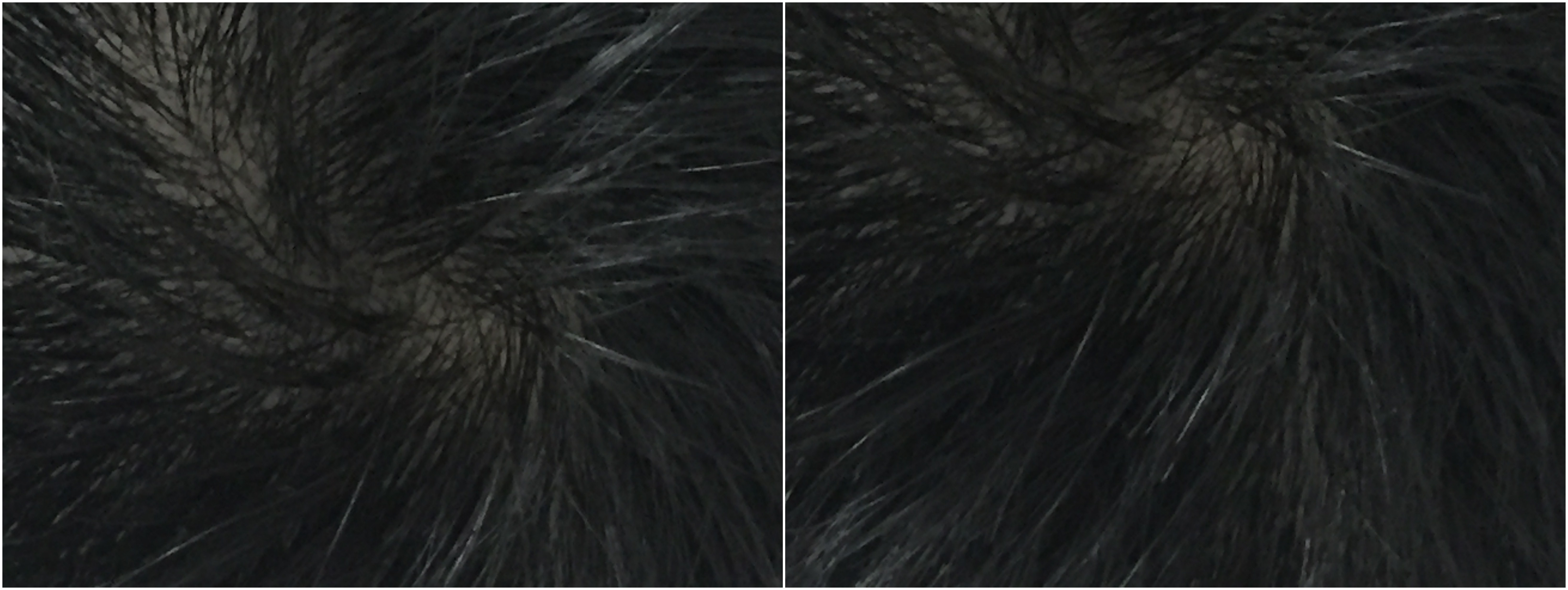 男士护发防脱大作战—我的头发养护四重奏