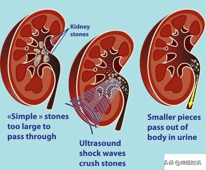 肾脏输尿管膀胱前列腺结构,肾输尿管膀胱解剖示意图