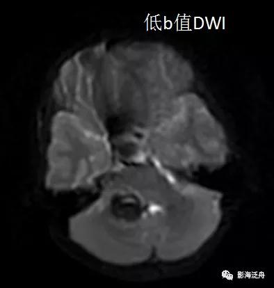 棰呰剳纾佸叡鎸痙wi搴忓垪,棰呰剳dwi搴忓垪鏈鏄庢樉寮傚父