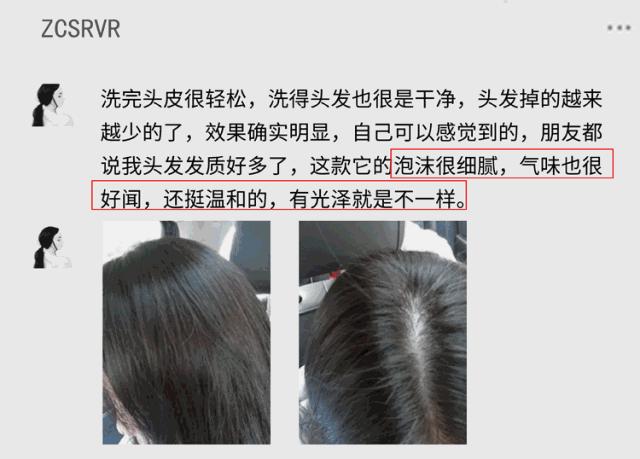 宋慧乔短发上热搜了,2020最火宋慧乔海藻卷