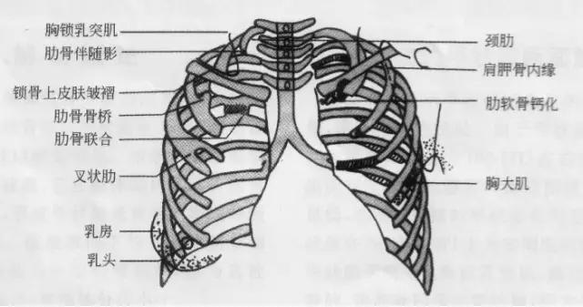 x线影像解剖大全,胸部x线怎么看懂图解