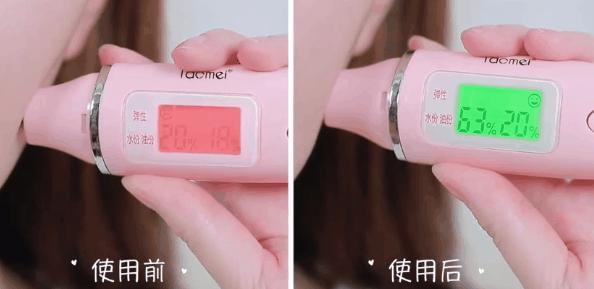 脸上长痘痘的原因和注意事项,脸上长痘痘到底应该怎么解决