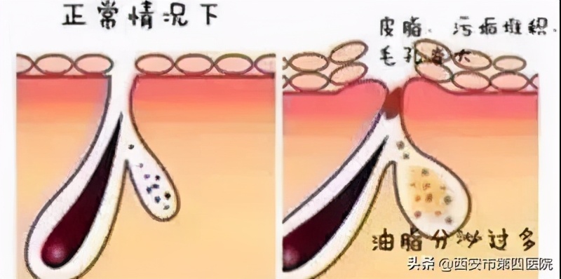 健康中国有哪些举措,健康中国行动攻略