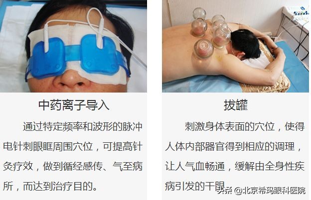 眼干来滴眼药水？年轻人，这些治疗方式比滴眼药水好使多了