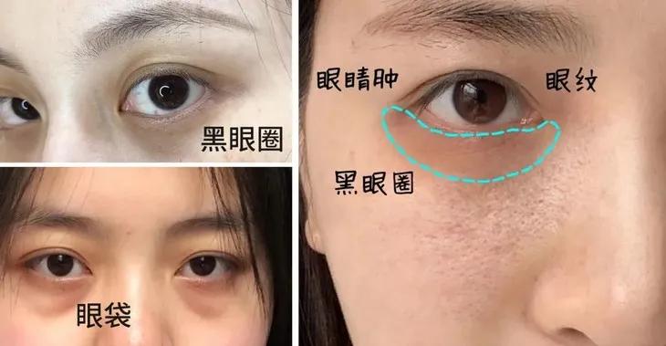 眼部保养重在“润”，用它一喷好舒服！细纹都慢慢膨了起来