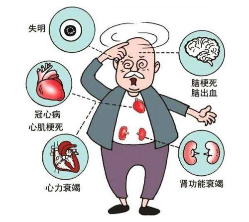 检查发现血压达到139/89mmHg，恭喜你？别急，其实这是一件好事！