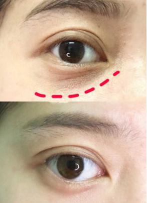 长得显老到底有多可怕,长得显老是一种什么样的体验