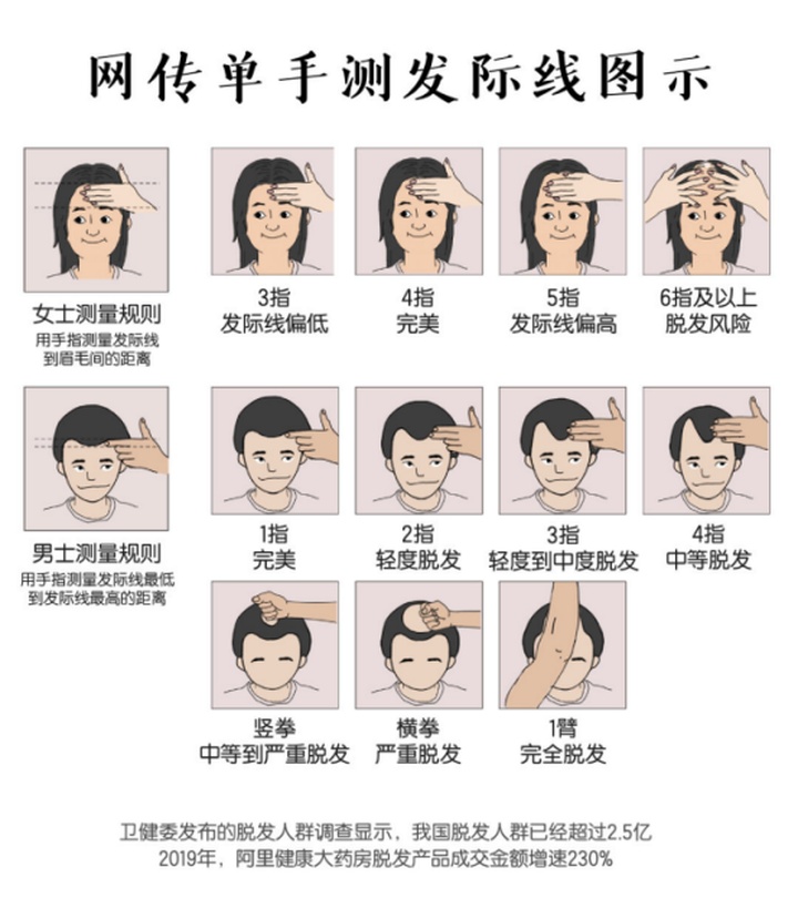 怎样辨别自己脱发,脱发判断最简单的方法