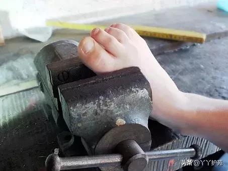 夜里痛风的快速止疼方法,脚丫子痛风怎么快速止疼