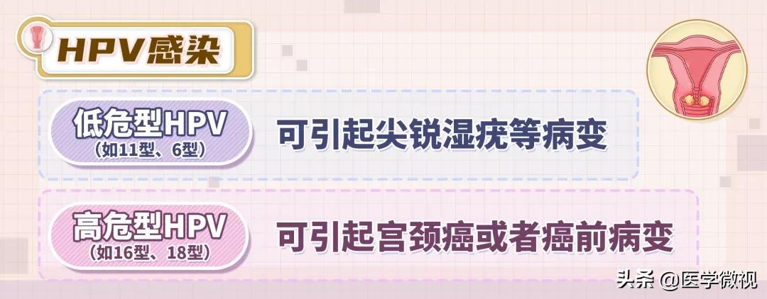 tct和hpv检查哪个确诊宫颈癌,宫颈癌tct检查是什么结果