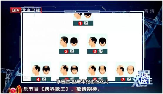 改善头发掉发最有效的方法,头发掉发最好的解决方法