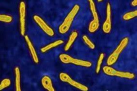 破伤风发病越早,得了破伤风不打破伤风针死亡率