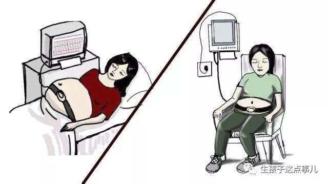 胎心监护每一次都要过关吗,胎心监护一定每次都过关吗