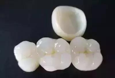 想配一副全瓷假牙要多少钱,做镍铬合金好还是钴铬烤瓷牙好