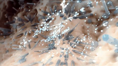 治痛风降尿酸记住这10点,运动排汗痛风