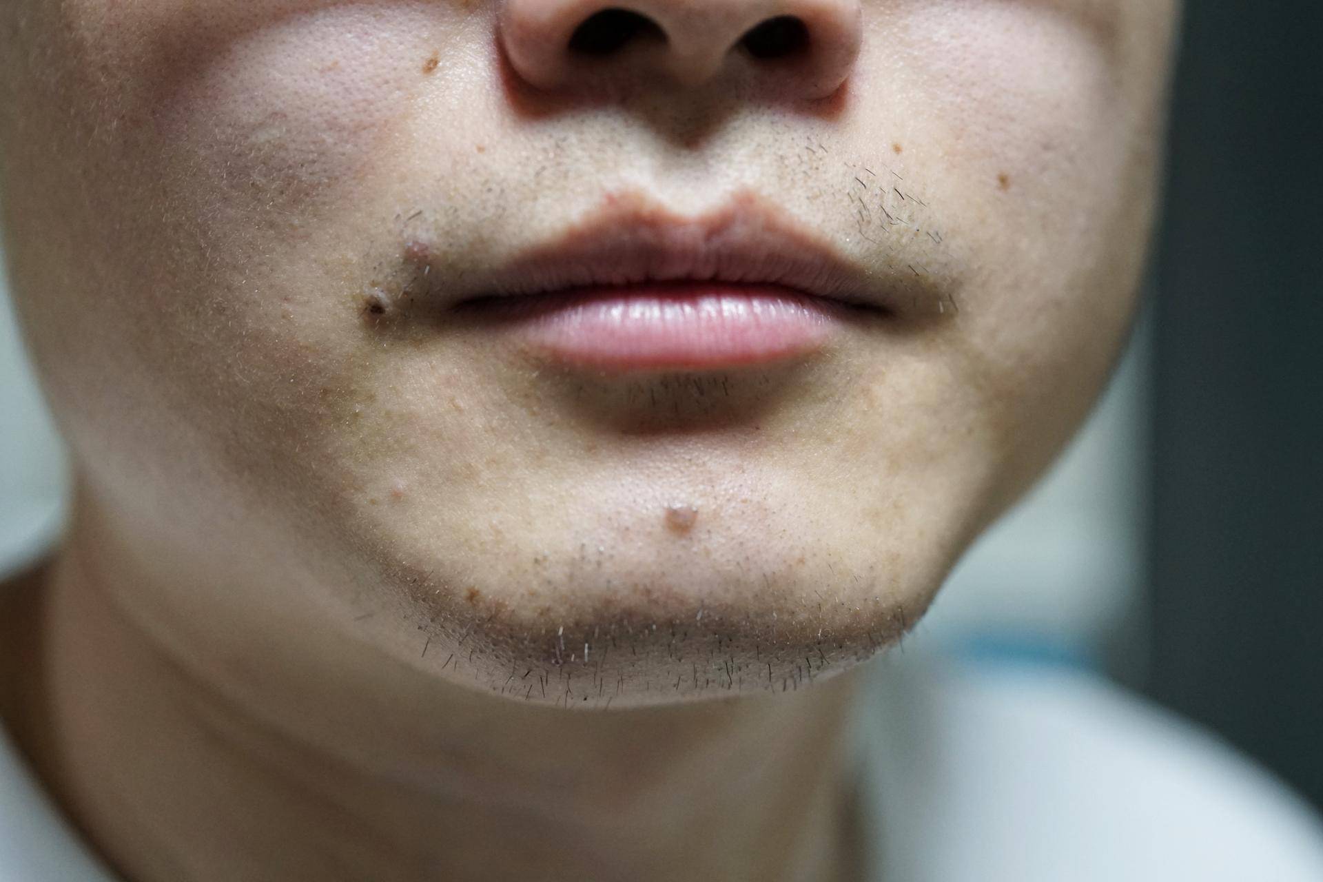 飞利浦series2000系,飞利浦series2000功能介绍