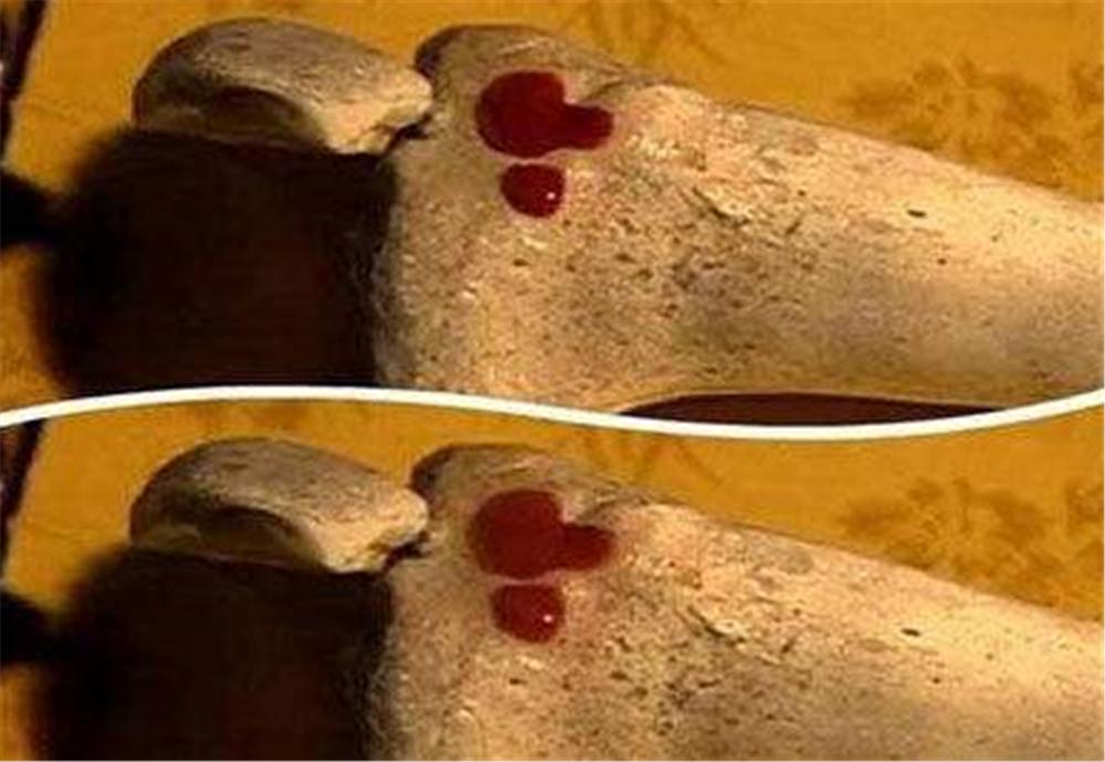 有什么血型比熊猫血型还稀有,比熊猫血还罕见的血型是什么血型