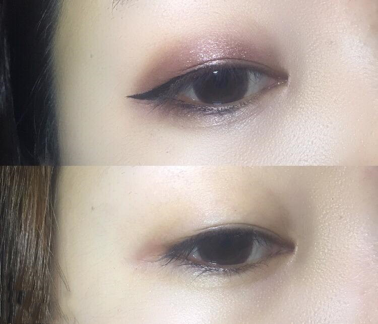 皮肤不清洁的后果视频,皮肤不清洁的危害