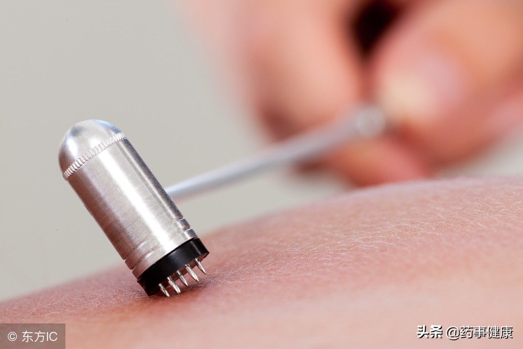 脱发越来越成为中青年人的烦心事，究竟如何摆脱秃顶的烦恼？