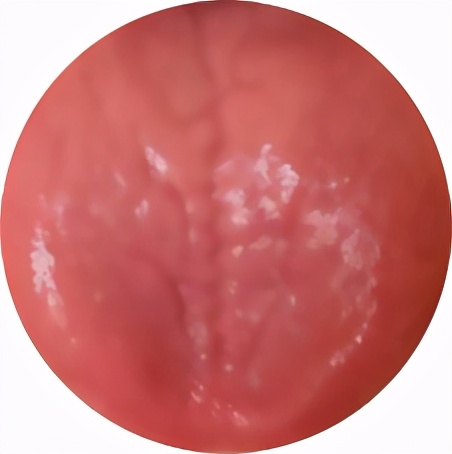 养肾等于续命？那如果是肾虚该怎么办？试试省中医的这个方法