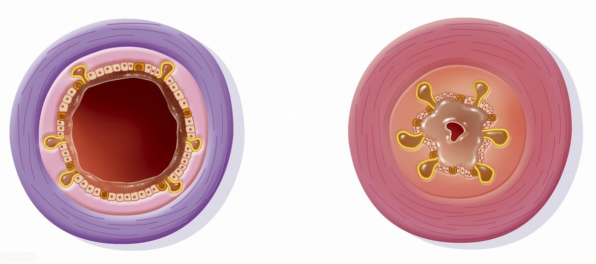 长期抽烟喝酒咳嗽有痰是什么原因,抽烟每天早上起来咳出黑色粘稠痰