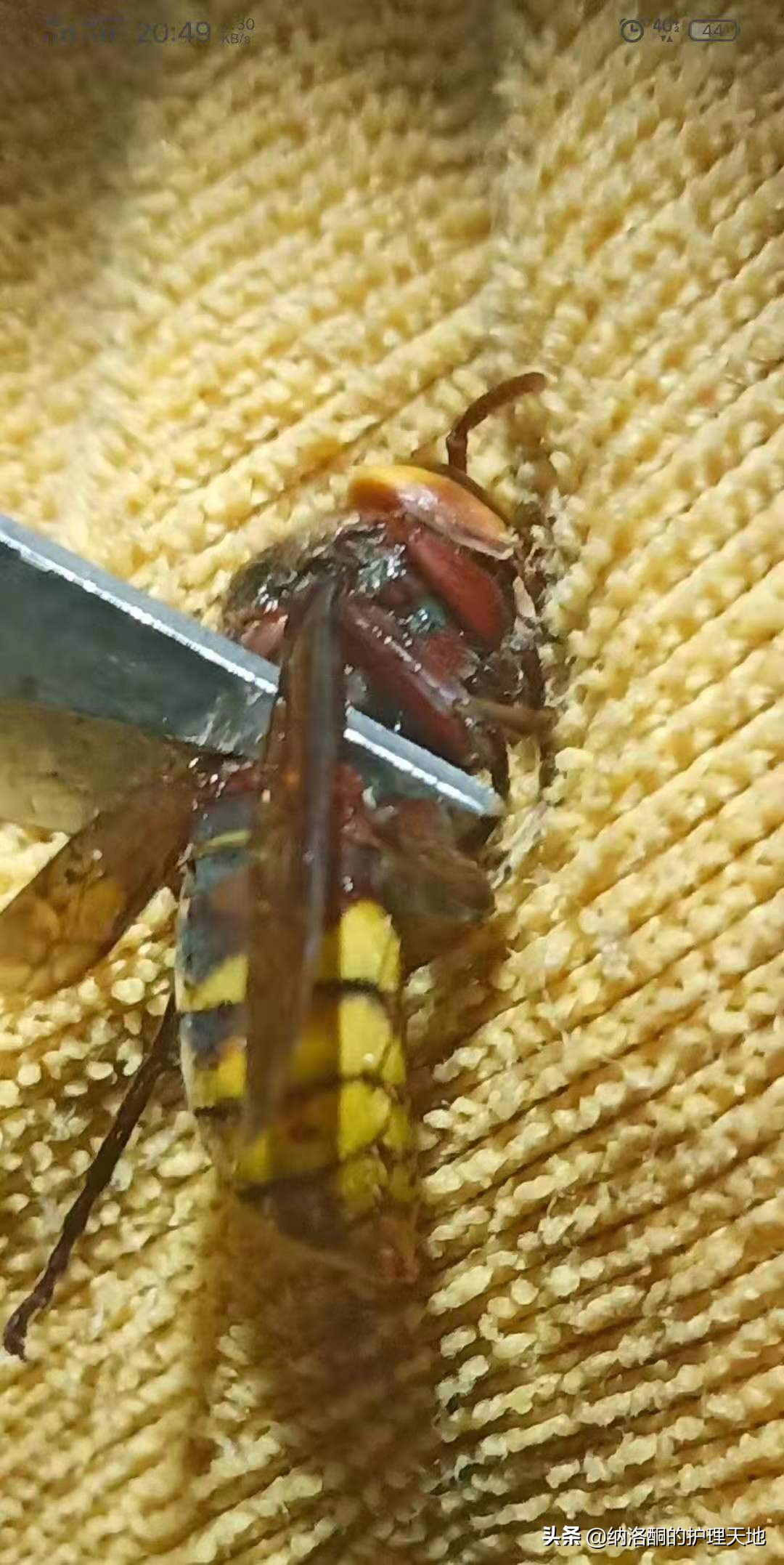 被金环胡蜂咬了肿了在家怎么办,被金环虎头蜂蛰了如何止疼