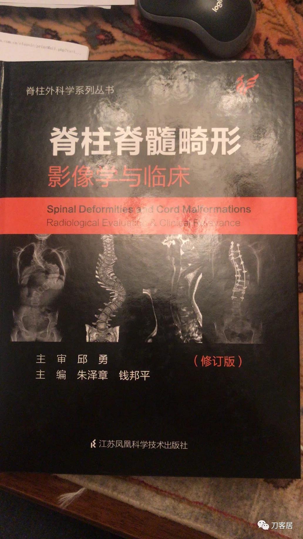 我的门诊病历：家族性神经纤维瘤病性脊柱侧凸