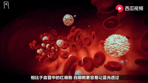 眼睛里有东西飘来飘去是怎么回事,眼睛里面有东西在飘是什么情况