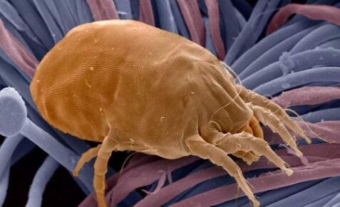 【鼻子最容易挤出这些白色的“条状物”，它到底是什么？】