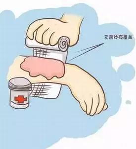 开水烫伤和烧伤哪个严重,为啥水蒸气烫伤比开水烫伤更严重