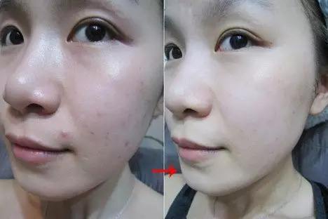 泫雅宣传品牌内衣，身材有致性感迷人，皮肤光滑透亮惹人爱