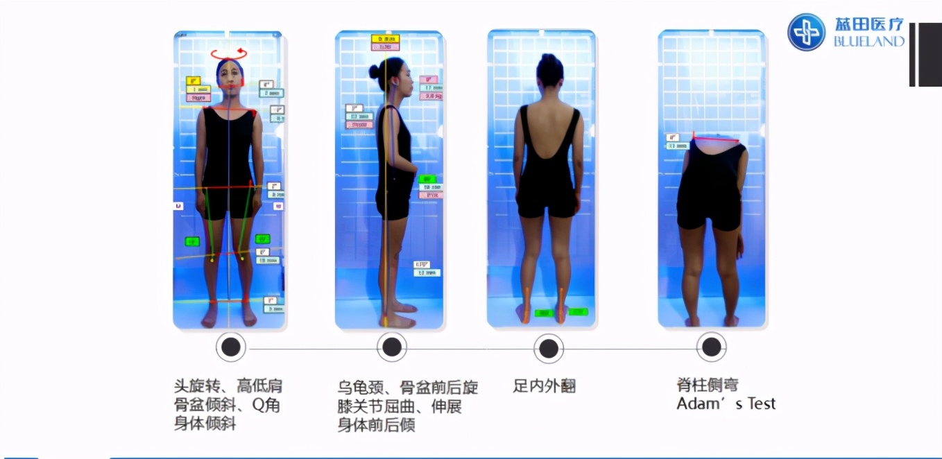 cmef国际医疗器械博览会2024分布图,cmef国际医疗器械博览会2023飞利浦