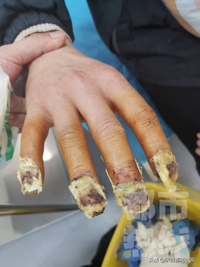 男子手卷入压面机后被救,男子被压面机咬手获救