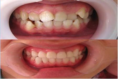 大连齿医生口腔种植牙怎么样,大连齿医生口腔门诊有限公司