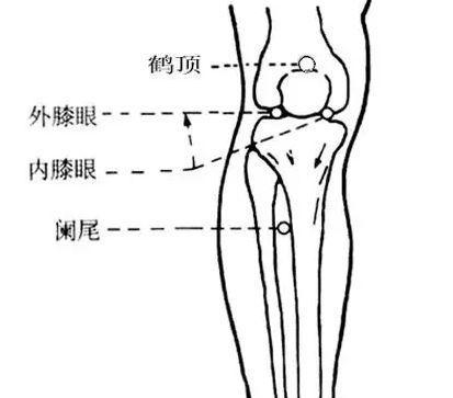 膝关节疼痛艾灸哪些穴位最好,膝关节内侧疼痛拔火罐穴位